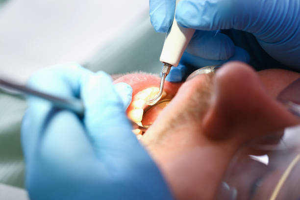 Best Broken or Cracked Tooth Emergency Dentist in Planada, CA