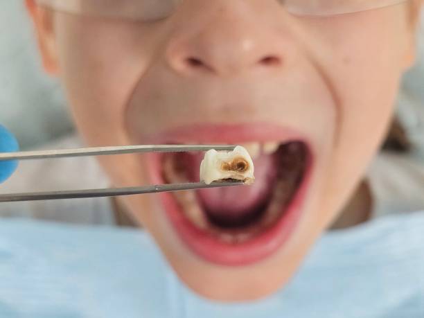 Best Pediatric Emergency Dentist in Planada, CA